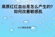 南昌高原红怎么治_南昌高原红医院哪家好