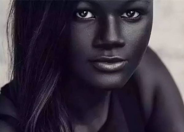 高原黑人皮肤变黑的原因_高原黑人如何防晒