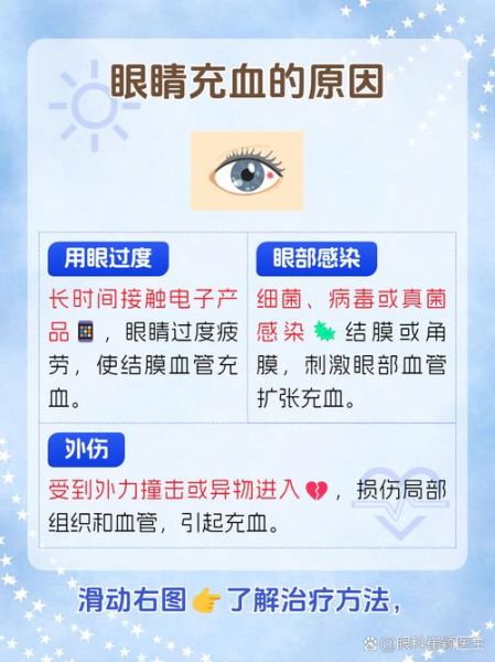 高原眼睛充血怎么办_高原反应眼睛红怎么缓解