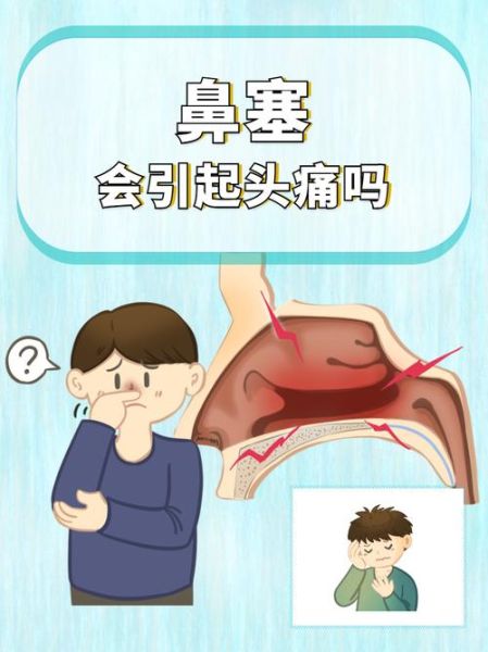 鼻塞能上高原吗_高原反应会加重鼻塞吗