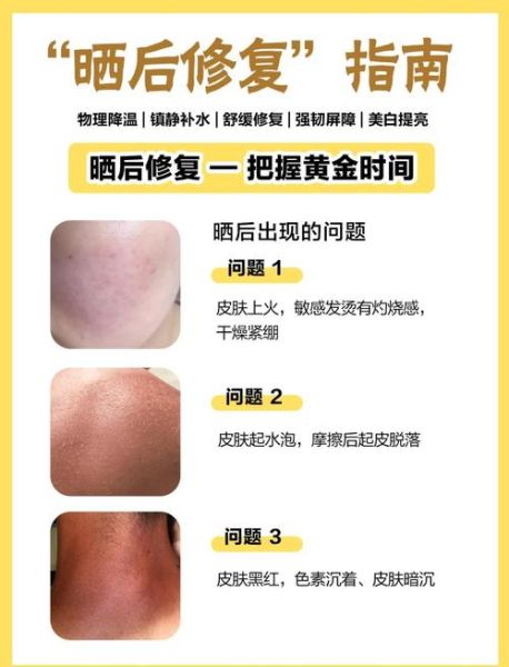 高原晒黑如何补救_晒后快速美白方法