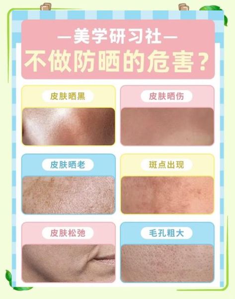 高原晒黑如何补救_晒后快速美白方法